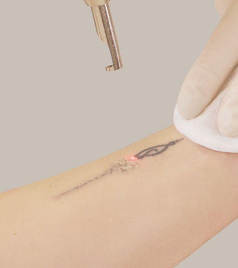 tatoo