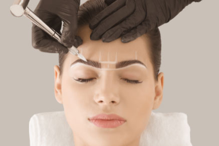 tattoo removal